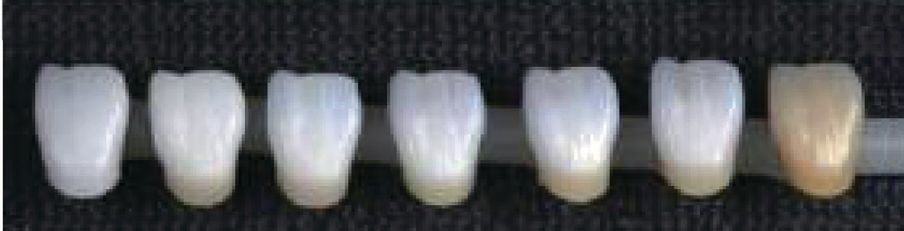 Aqua Coloring anterior sample bottom left