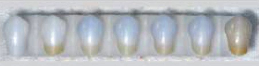 Aqua Coloring anterior sample bottom right