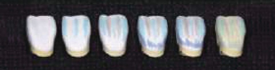 Aqua Coloring anterior sample top left
