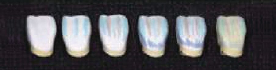 Aqua Coloring anterior sample top left