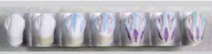 Aqua Coloring anterior sample top right