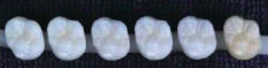 Aqua Coloring posterior sample bottom right