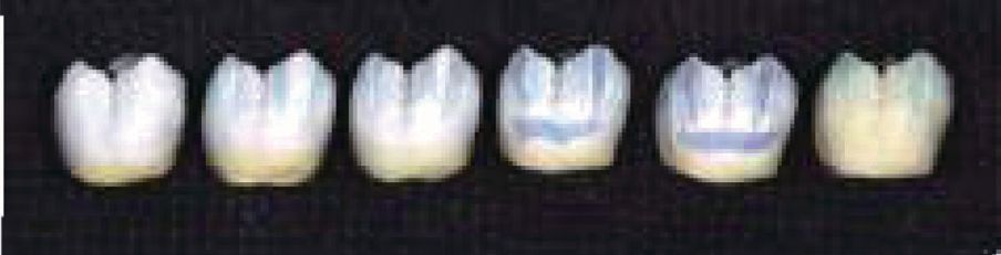 Aqua Coloring posterior sample top left