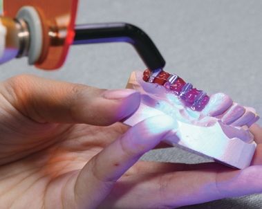 JIG-GEL intraoral example