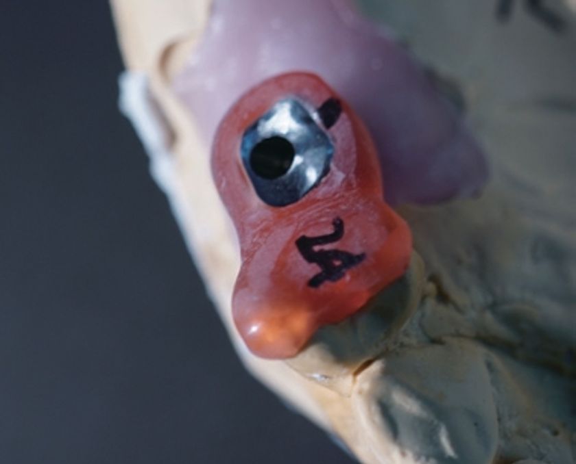 JIG-GEL implant jig example